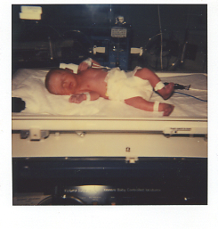 Premature baby Girl